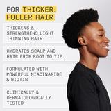 Nioxin System 1 Scalp Therapy Conditioner for Fine/Normal to Light Thinning, Natural Non Color-Treated Hair